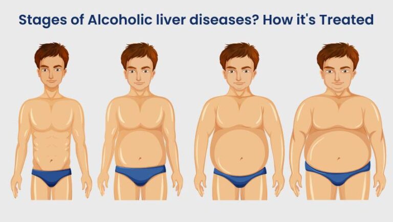 alcoholic-liver-disease-medizzy