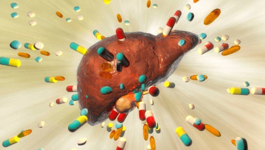 drug-induced liver disease