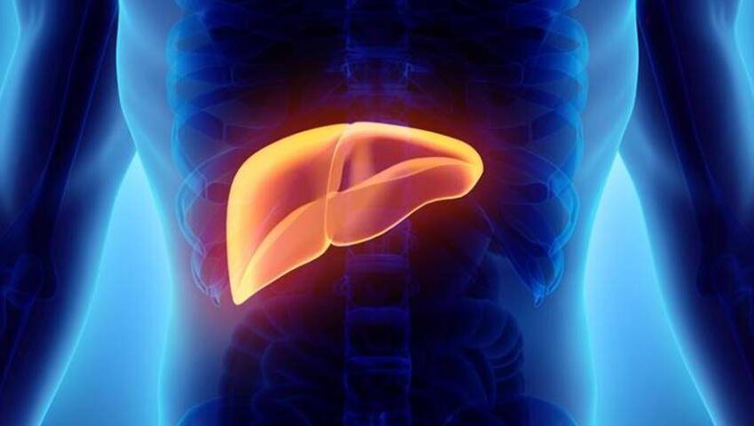 Fatty Liver Disease