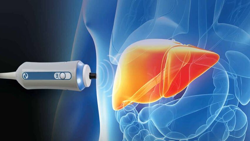 The Importance of Fibroscan in Liver Disease Diagnosis