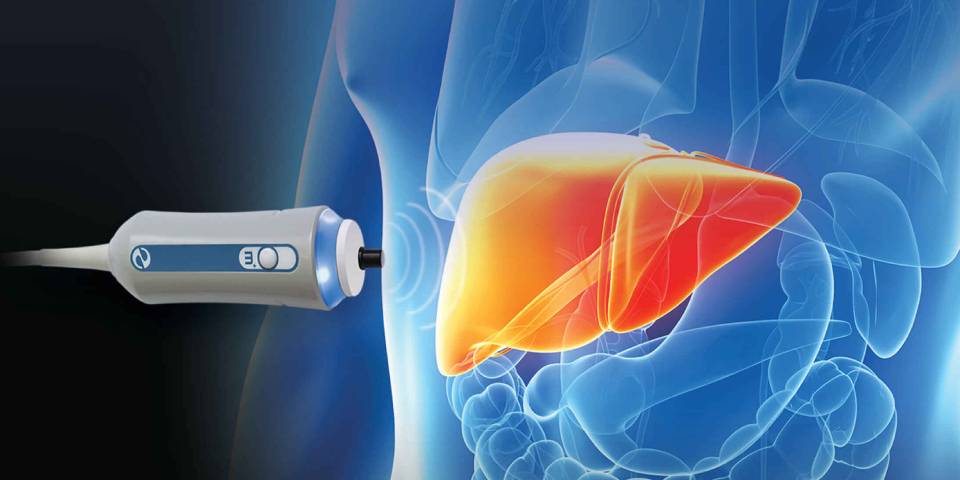 The Importance of Fibroscan in Liver Disease Diagnosis