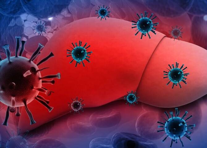 Hepatitis A – Causes, Symptoms, Treatment and Prevention