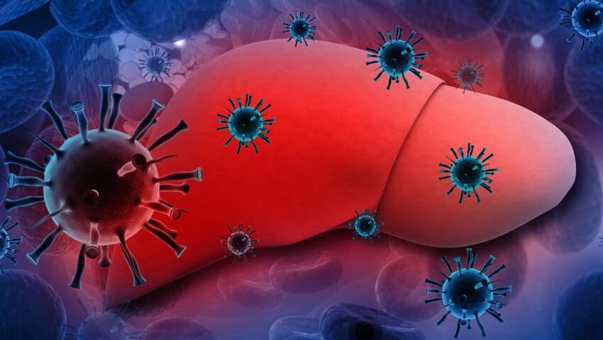 Hepatitis A – Causes, Symptoms, Treatment and Prevention