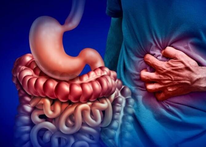 What are the most common extraintestinal complications of IBD?