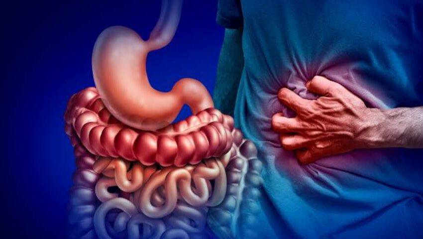 What are the most common extraintestinal complications of IBD?